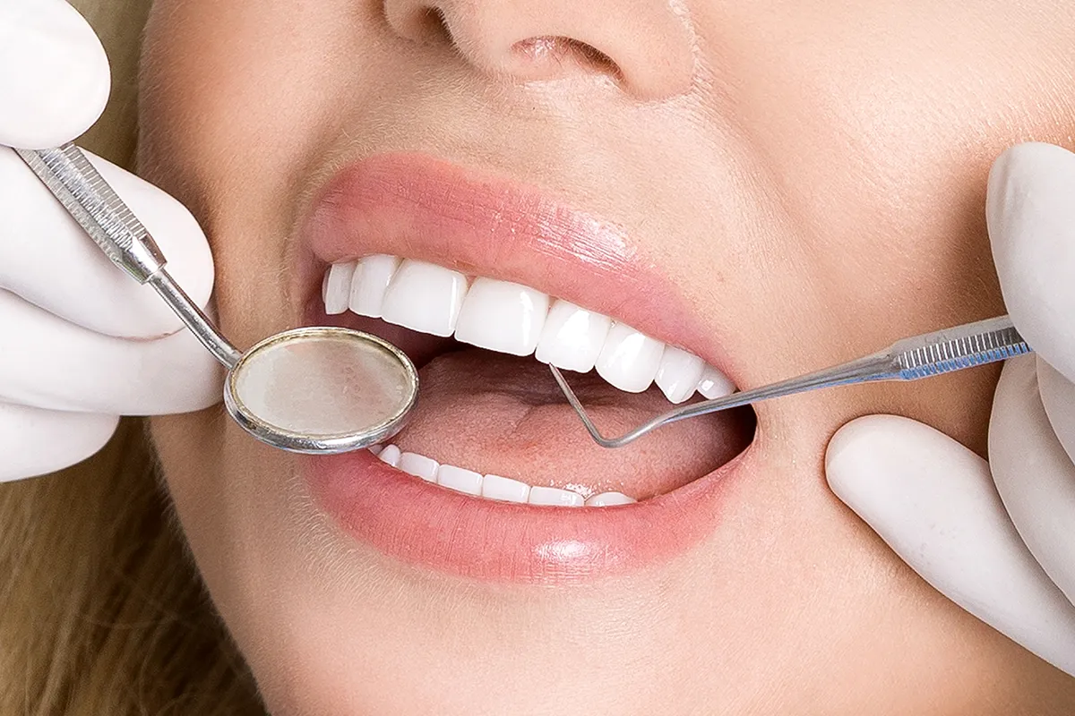 Keçiören Diş Polikliniğinde Estetik Diş Kaplama Yöntemleri