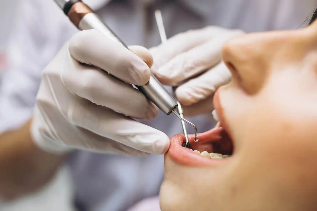 Etlik Root Canal Retreatment
